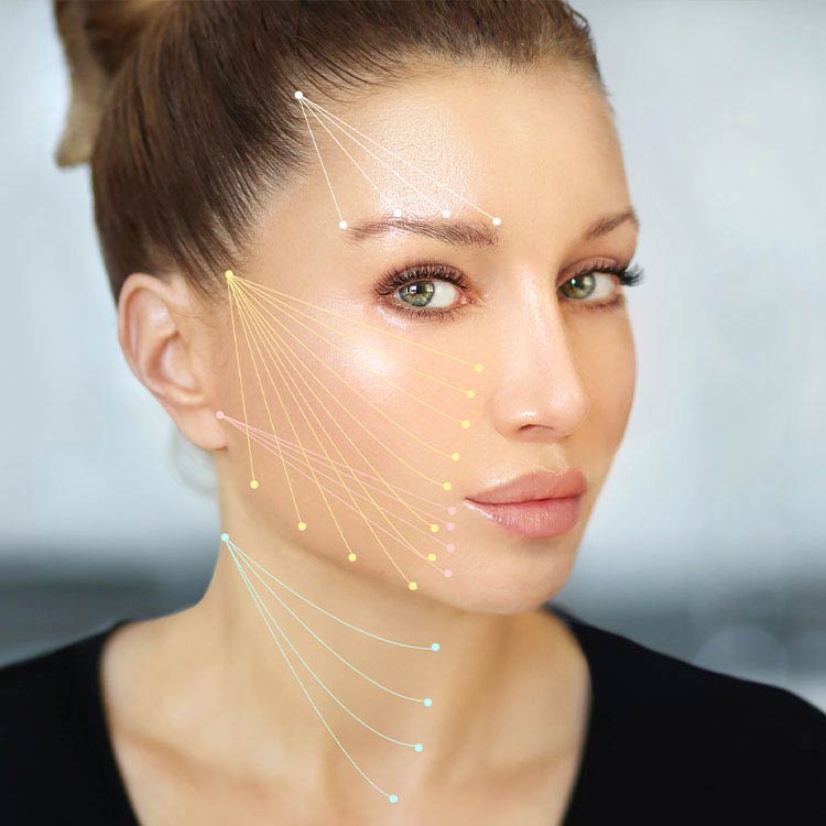 illari Threads Instagram photo illustrating various positions within face a PDO Thread lift can be implemented